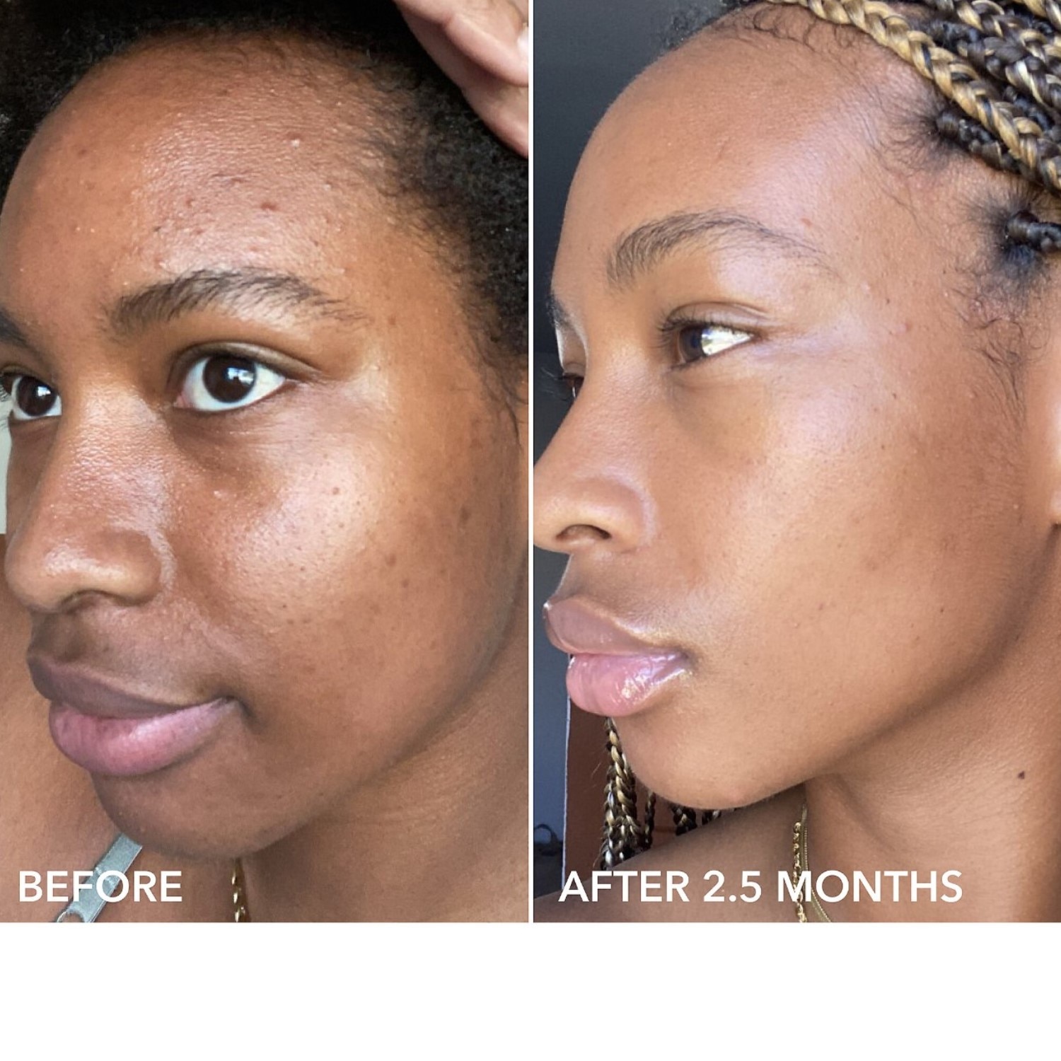 ALPHA BETA UNIVERSAL DAILY PEEL (ALMOHADILLAS EXFOLIANTES DIARIAS UNIVERSALES)